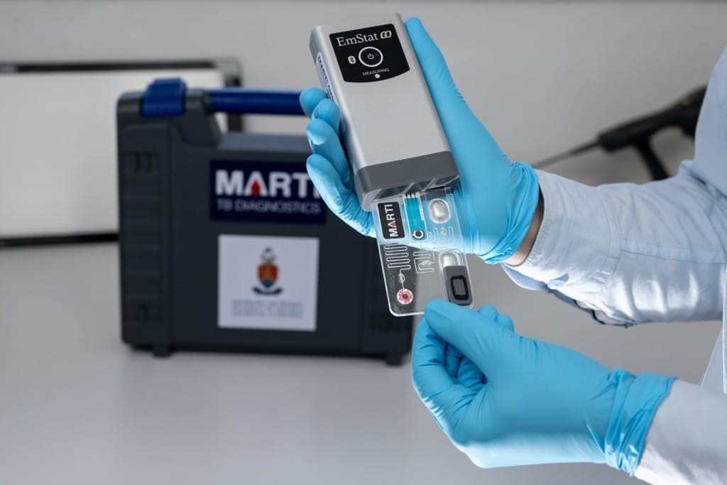Die handtoestel, genaamd MARTI, se uitslae in binne 30 minute beskikbaar. Foto: Universiteit van Pretoria